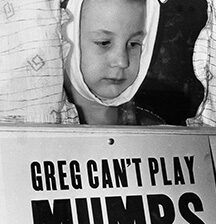 mumps